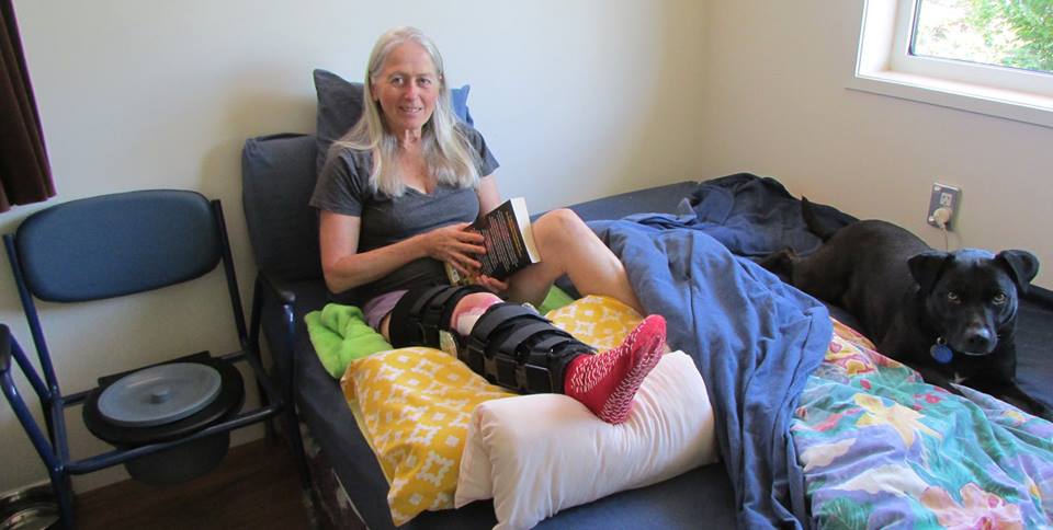 Linda Broken Leg
